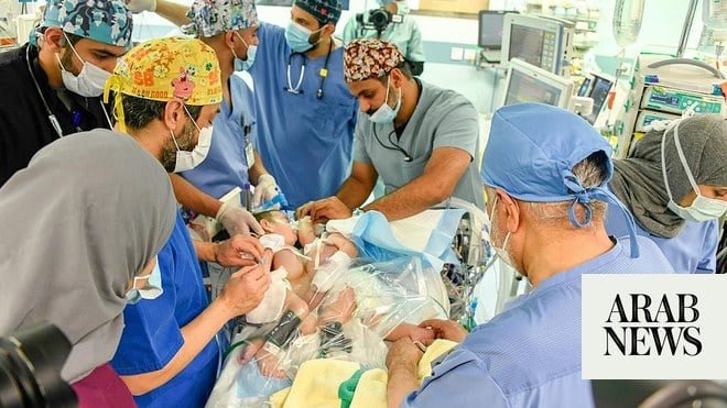 بدء جراحة فصل التوائم الملتصقة العراقية بالرياض بدء جراحة فصل التوائم الملتصقة العراقية بالرياض